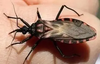 Imagen ¿Qué es el mal de Chagas y cuáles son sus síntomas?