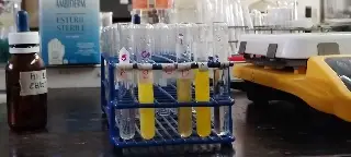 Imagen Alerta de venenos silenciosos cómo el plomo y arsénico
