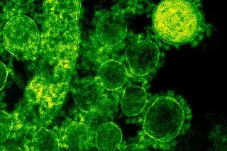Imagen Revelan un complejo mecanismo de defensa de  bacterias contra los virus que las atacan