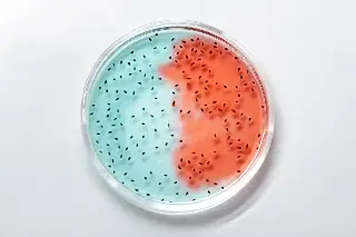 Imagen Estudio: Efectos de una bacteria sobre la inmunidad innata abren vía para prevenir la obesidad