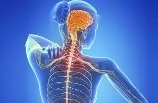 Imagen Esclerosis múltiple, enfermedad que no tiene cura, ¿Cómo prevenirla?