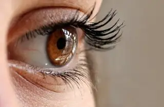 Imagen ¿Qué es el queratocono? La enfermedad ocular por la que puedes perder la visión  