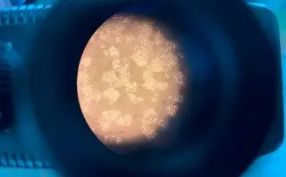 Imagen UNAM identifica marcadores tempranos para atender cáncer de hígado y cirrosis 