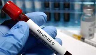 Imagen ¿Cuántos tipos de hepatitis hay y cuál es la más peligrosa? Esto dice médico