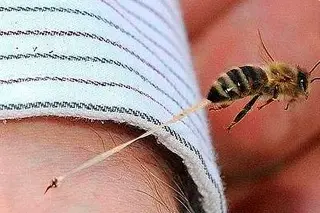 Imagen ¿La picadura de una abeja causa más muertes que la de alacrán o mordida de serpiente?