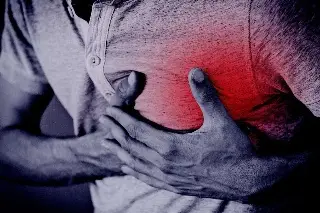 Imagen ¿Qué hacer en caso de un infarto?