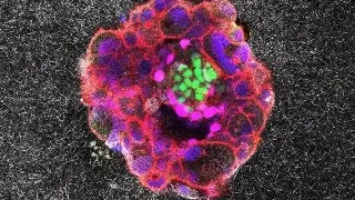 Imagen Graban por primera vez el proceso de implantación de un embrión humano en tiempo real