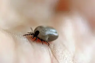 Imagen Muere menor de 15 años por rickettsiosis tras ser picado por garrapata en Durango