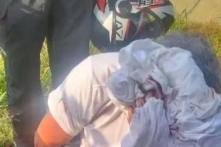 Por bache en carretera Veracruz-Xalapa cae motociclista 
