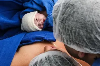 Imagen La OMS emite guía para reducir las 45 mil muertes anuales por hemorragia posparto