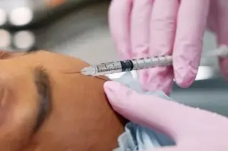 Imagen Desarrollan un sistema que usa la IA para identificar rellenos estéticos en la piel