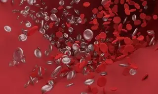 Imagen La trombosis puede ser mortal ¿Qué la provoca y cómo identificarla a tiempo?