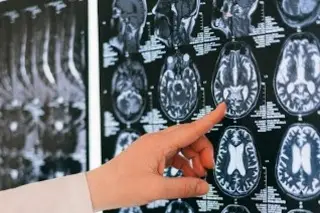 Imagen Cerebro humano viene 'preconfigurado' con instrucciones para comprender el mundo: Estudio