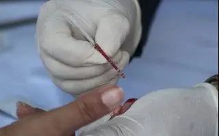 Imagen Hoy es el Día Mundial contra el Sida 