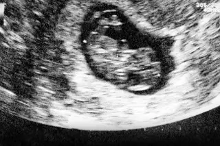 Exposición prenatal al calor húmedo extremo frena crecimiento de los niños, según estudio