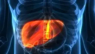 ¿Dieta rica en grasas aumenta la probabilidad de cáncer de hígado? Esto dice estudio 