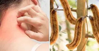 ¿De dónde sale el 'pica pica' que afecta a los jarochos durante los eventos del norte?