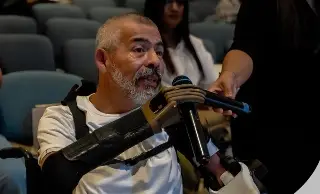 Imagen Esto podrá hacer el señor que tuvo acceso a prótesis tras perder sus brazos en Veracruz