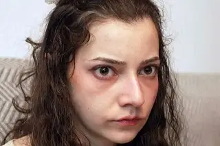 Muere Noelia Castillo Ramos a los 25 años, tras solicitar la eutanasia