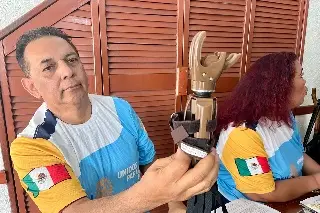 Buscan desarrollar mano biónica tras proyecto de prótesis mecánica en Veracruz