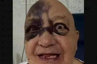 Preocupa Luis de Alba al aparecer con golpes en el rostro (+Video)