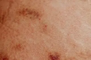 Destacadas