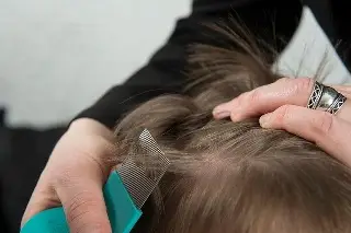 Alertan por aumento de casos de piojos ¿Cómo evitar el contagio?