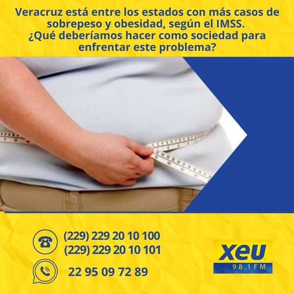 Imagen #Veracruz está entre los estados con más casos de sobrepeso y obesidad, según el #IMSS. ¿Qué deberíamos hacer como sociedad para enfrentar este problema? 