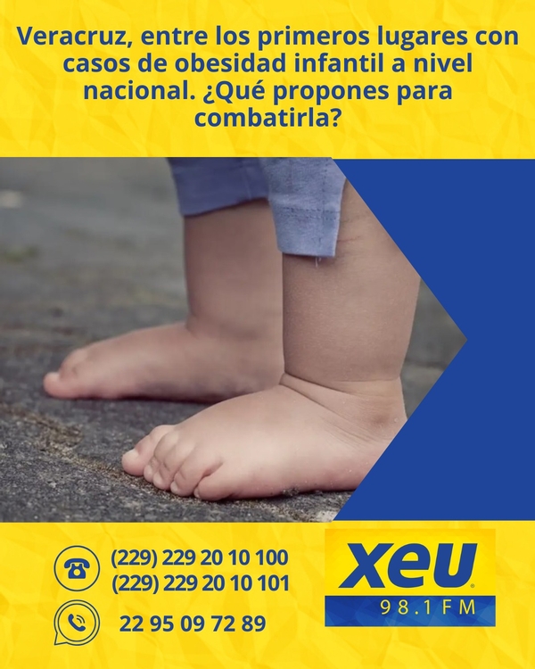 Imagen Veracruz, entre los primeros lugares con casos de obesidad infantil a nivel nacional. ¿Qué propones para combatirla?